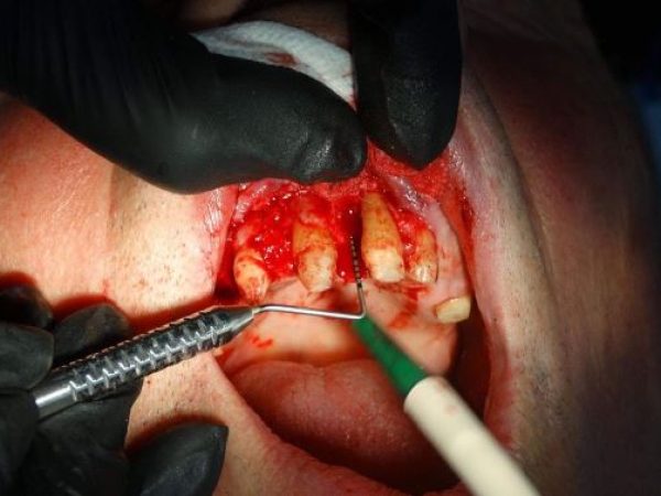 paromed dental